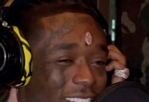Un diamant de plus de 20 millions de dollars implanté sur son front, Lil Uzi Vert explique les risques