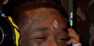 Un diamant de plus de 20 millions de dollars implanté sur son front, Lil Uzi Vert explique les risques