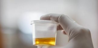 Voici quelques conseils santés sur les bienfaits de l’urine