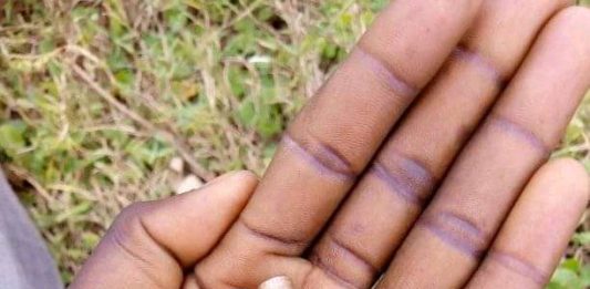 Nord-Kivu : un manifestant tué par un policier à Butembo, le maire annonce des enquêtes pour arrêter le vrai auteur