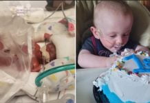 Le bébé le plus prématuré du monde vient de fêter son premier anniversaire