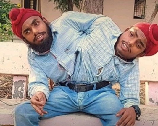 En Inde, deux frères siamois ont trouvé leur première embauche !