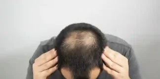 Une recette naturelle et très simple pour lutter contre la perte de cheveux !