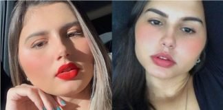 Nés hommes, ces jumeaux décident d’avoir recours à la chirurgie pour devenir jumelles !