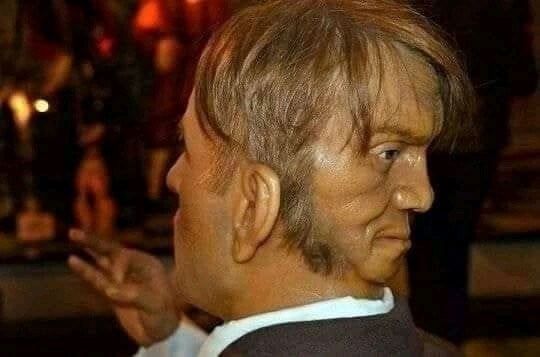 Découvrez l'histoire incroyable de ce jeune homme de 23 ans avec ses deux visages 1 Découvrez l'histoire incroyable de ce jeune homme de 23 ans avec ses deux visages 1
