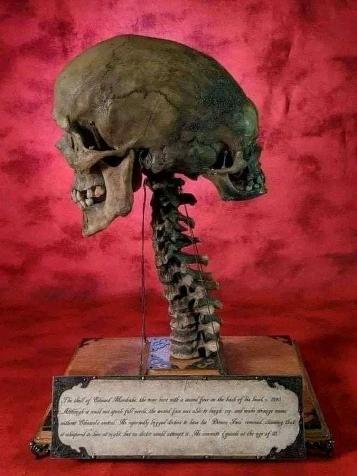 Découvrez l'histoire incroyable de ce jeune homme de 23 ans avec ses deux visages 3 Découvrez l'histoire incroyable de ce jeune homme de 23 ans avec ses deux visages 3