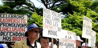 Un prêtre condamné à 30 ans de prison dans l’affaire d’un albinos tué et démembré au Malawi