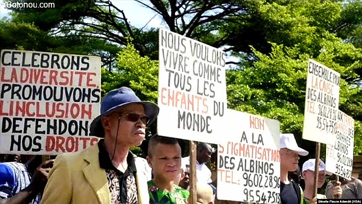 Un prêtre condamné à 30 ans de prison dans l'affaire d'un albinos tué et démembré au Malawi 1 Un prêtre condamné à 30 ans de prison dans l'affaire d'un albinos tué et démembré au Malawi 1