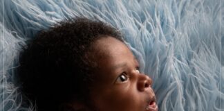 RDC : une femme donne naissance à un hermaphrodite au visage inexplicable