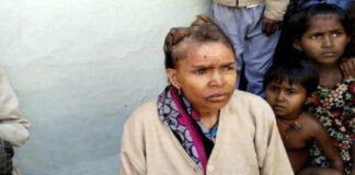 Une femme développe des «cornes» sur la tête