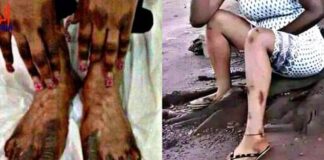 RDC : voulant devenir blanche, voici ce qu’elle trouve comme résultat